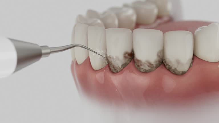 Reliable Dental contractor in Long Lake, IL by Dentist Open Now